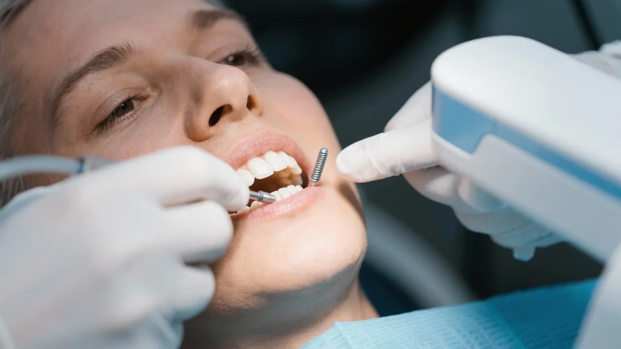 Comprehensive Guide to Dental Implants